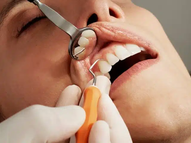 Dentist using a dental mirror and probe to examine a patient's teeth — pre-travel dental care in Singapore
