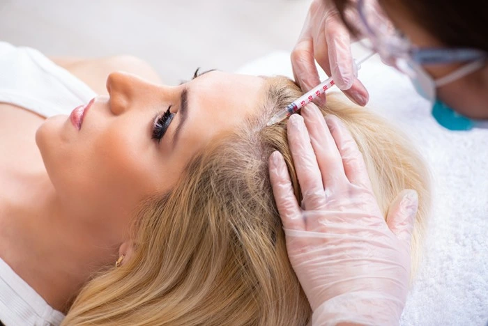 Close-up of an injection being administered to the scalp as part of a surgical hair restoration procedure