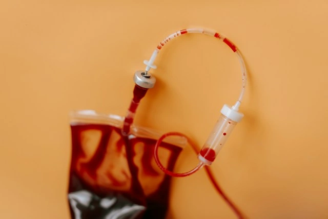 Blood transfusion bag connected to implantable port tubing for treatment records