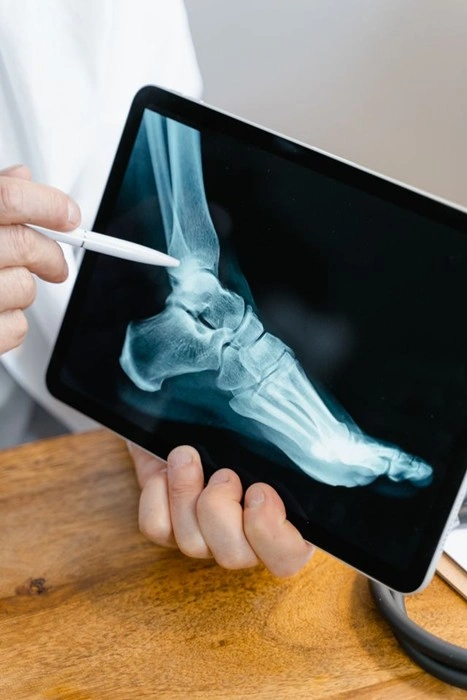 Doctor reviewing X-ray imaging as part of injury follow-up care