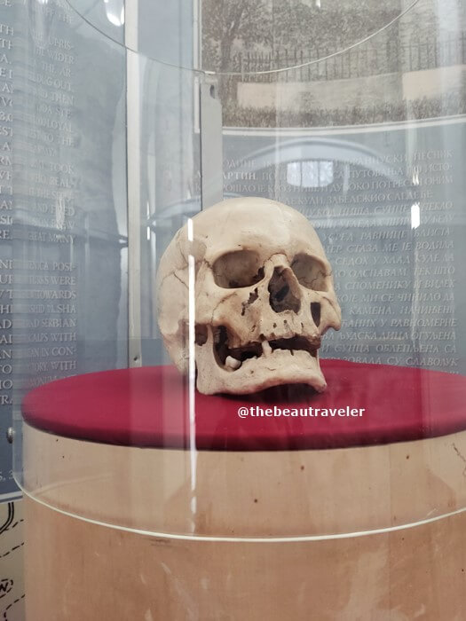 The skull that is believed to be the late general Stevan Sindelic, the leader of the First Serbian Uprising who died during the Battle of Cegar in 1809.