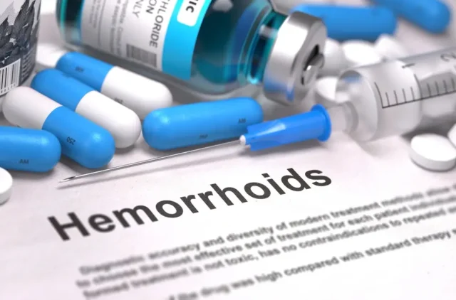 How to Treat Hemorrhoids: 6 Effective Home Care Tips