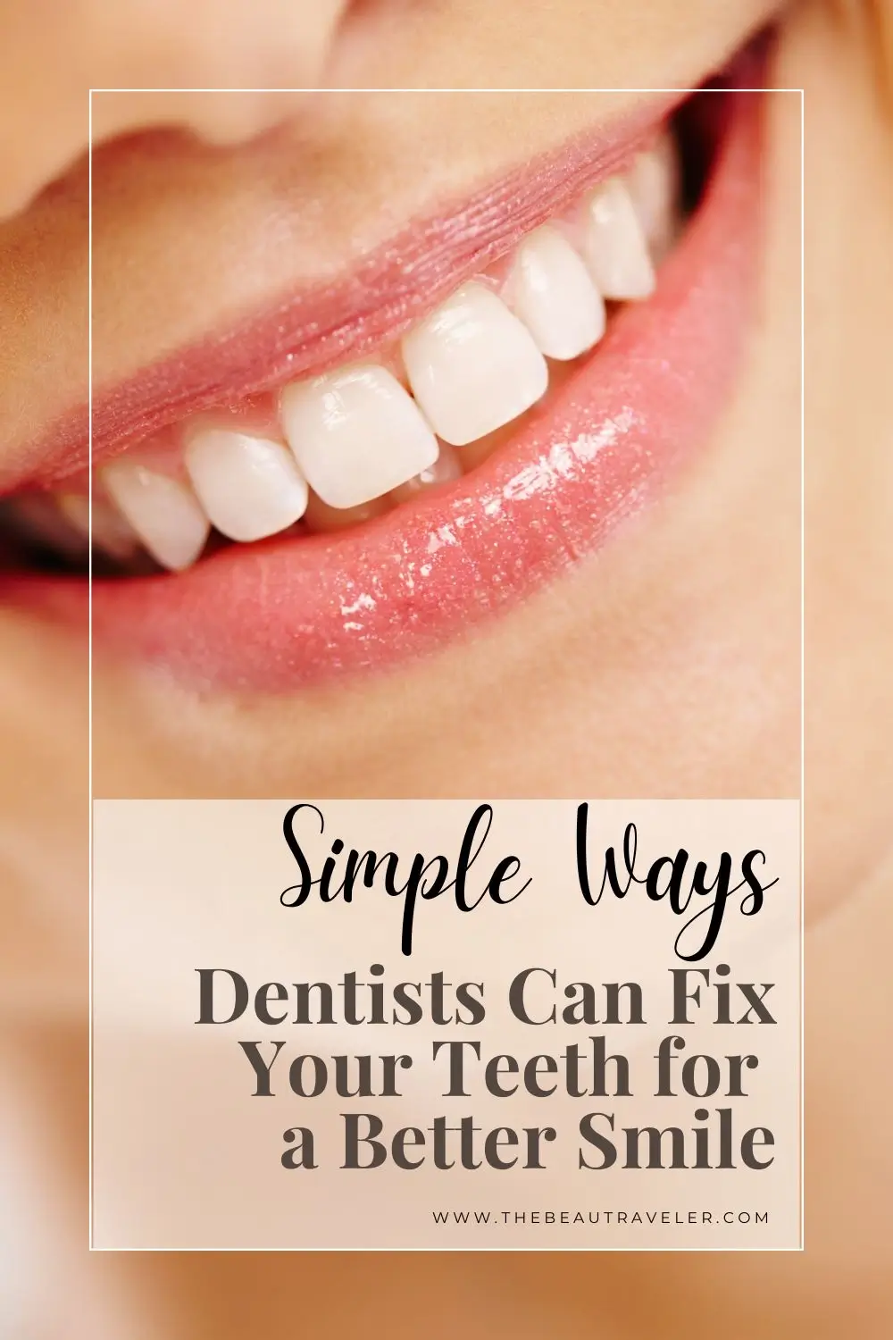 How to Enhance Your Smile with Dental Cosmetics - The BeauTraveler