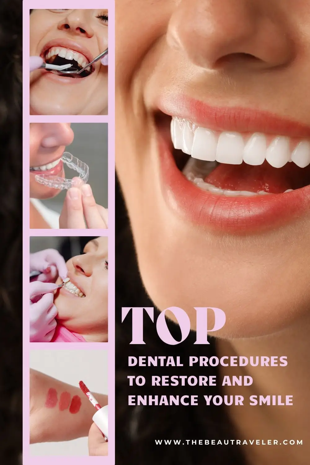 How to Enhance Your Smile with Dental Cosmetics - The BeauTraveler