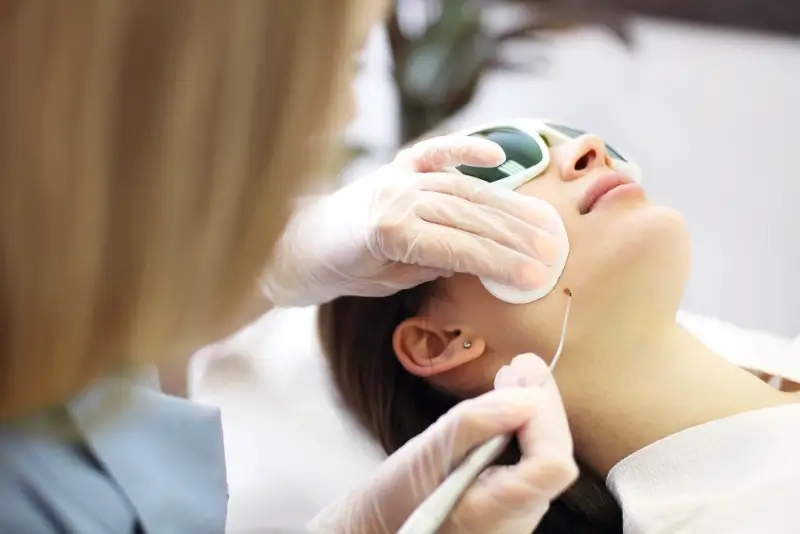 Medical procedure for mole removal